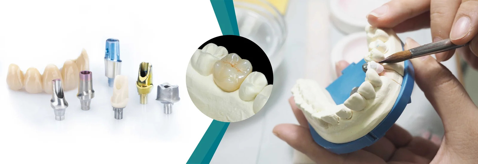 Dental restoration products and hand finishing