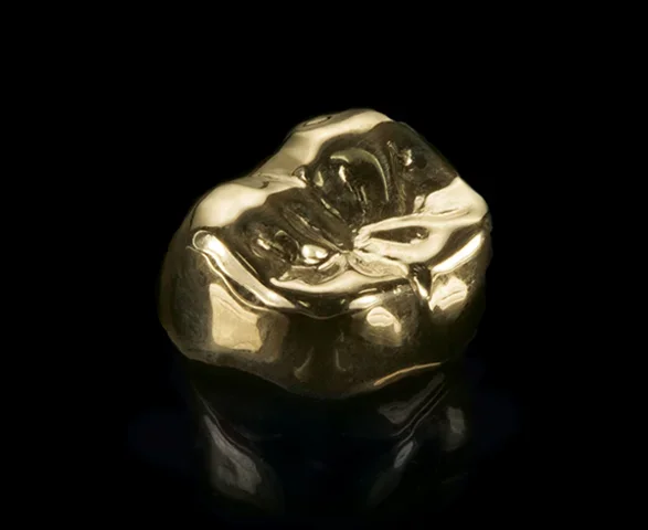 贵金属冠
